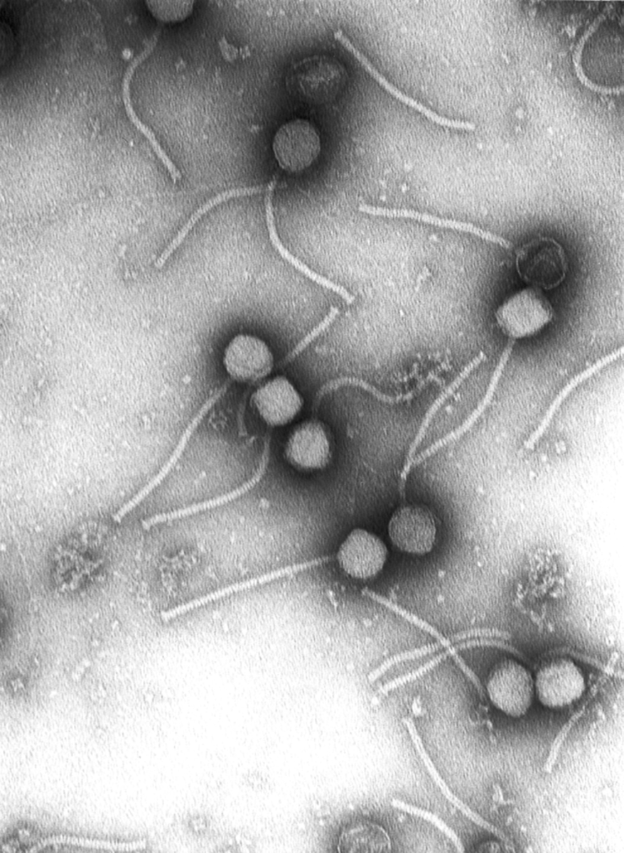 Bacteriophages can be seen under an electron microscope. This is the gamma phage.