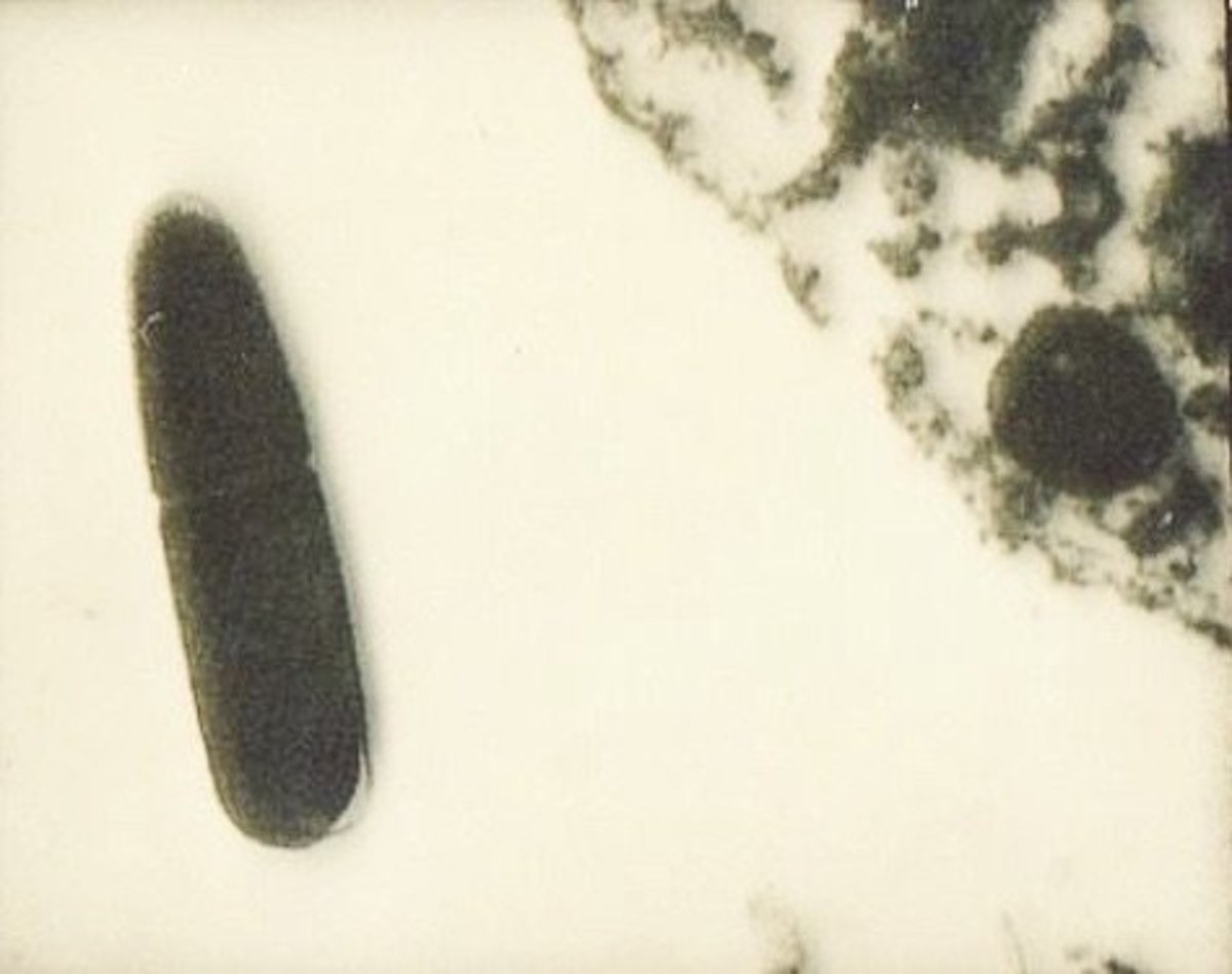 Клостридиоз кал микроскопия