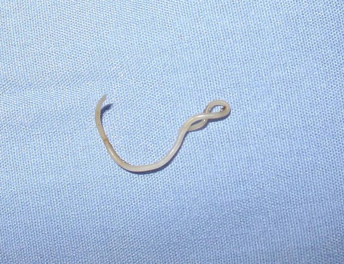 This is a roundworm. They are typically ingested as eggs and can grow several feet long.