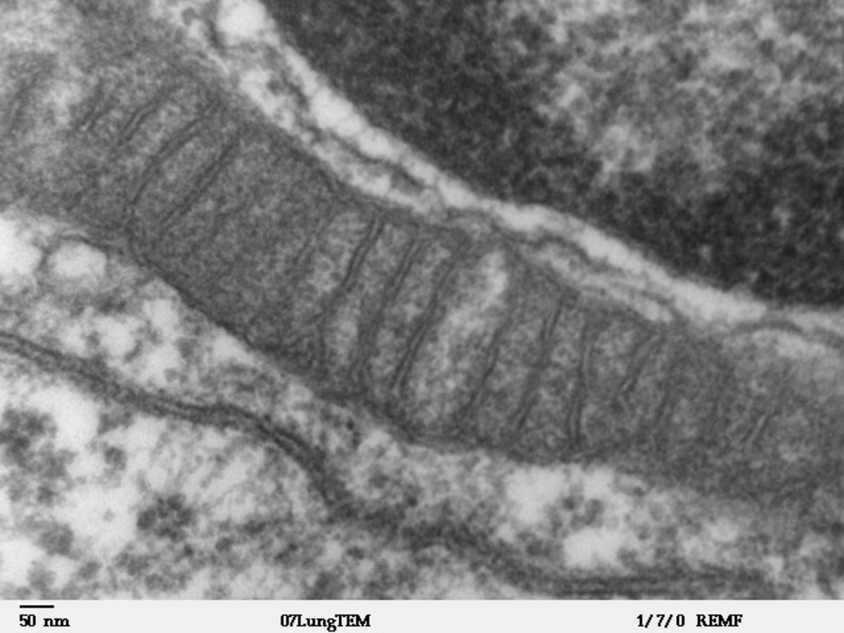 This is what a mitochondrion looks like seen by an electron microscope. The little compartments inside are called lumen and it's in there that respiration occurs.