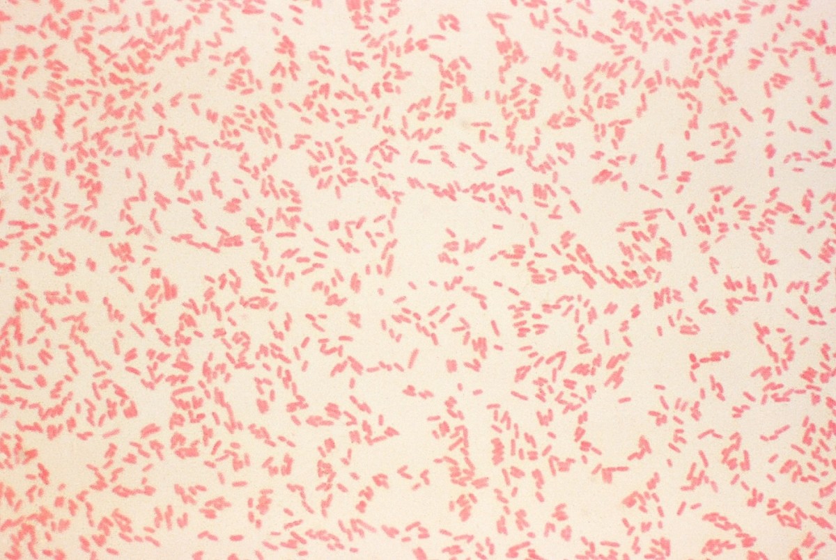 These are Yersinia enterocolitica cells that have been gram stained.