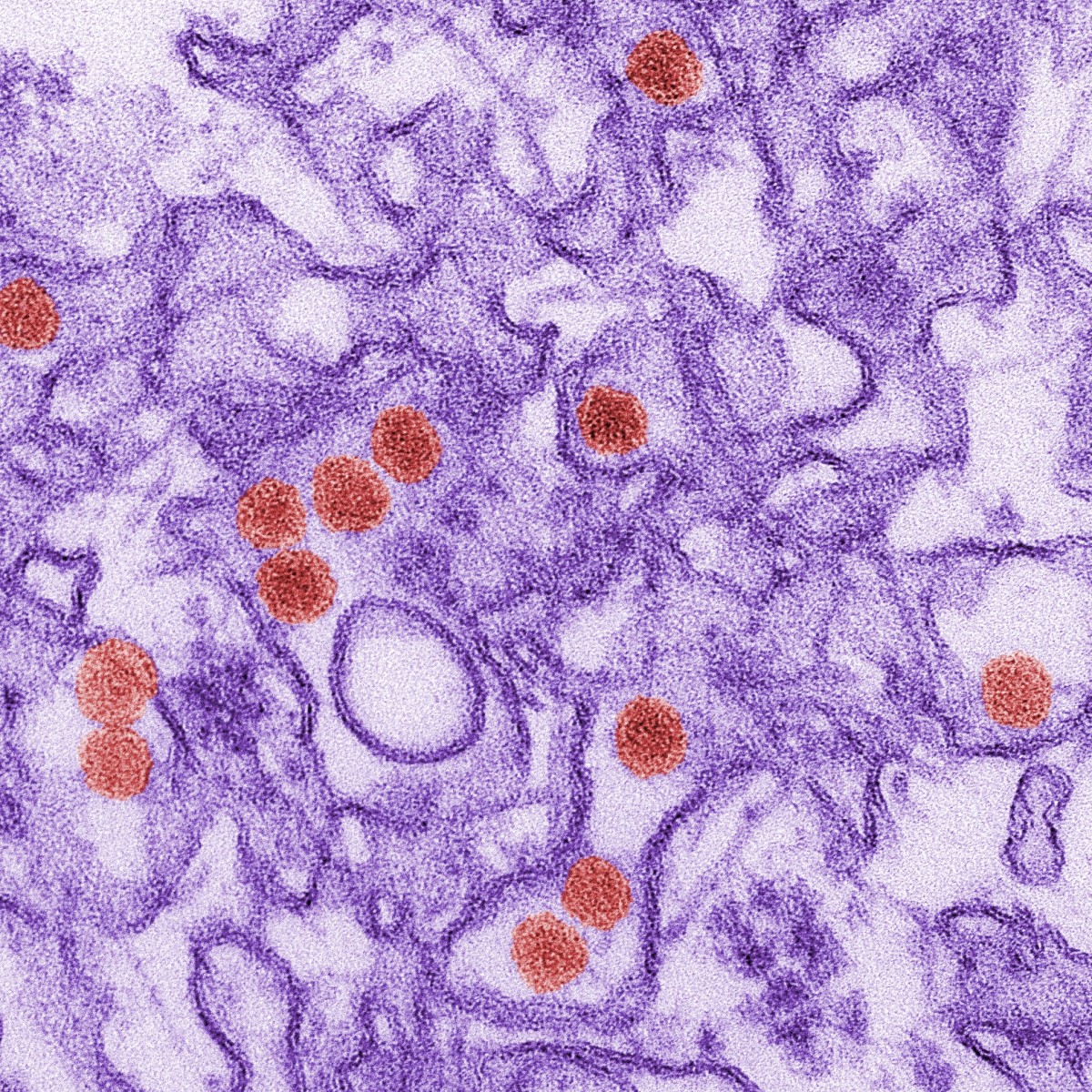 Zika virus (artificially coloured red)