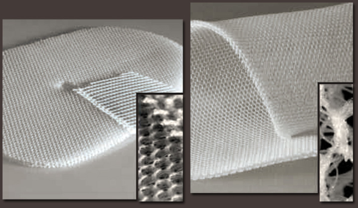 Surgical mesh comes in different shapes, sizes, and weaves.