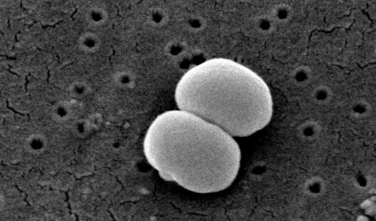 An enlarged view of two Staphylococcus epidermidis cells
