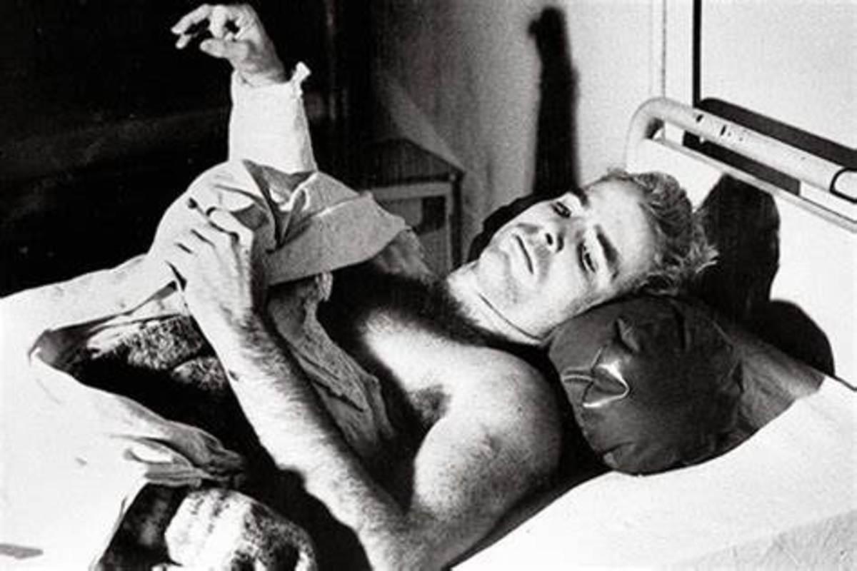 McCain in the prison hospital a few days after being shot down. His right arm was not only broken, but his shoulder had been shattered.