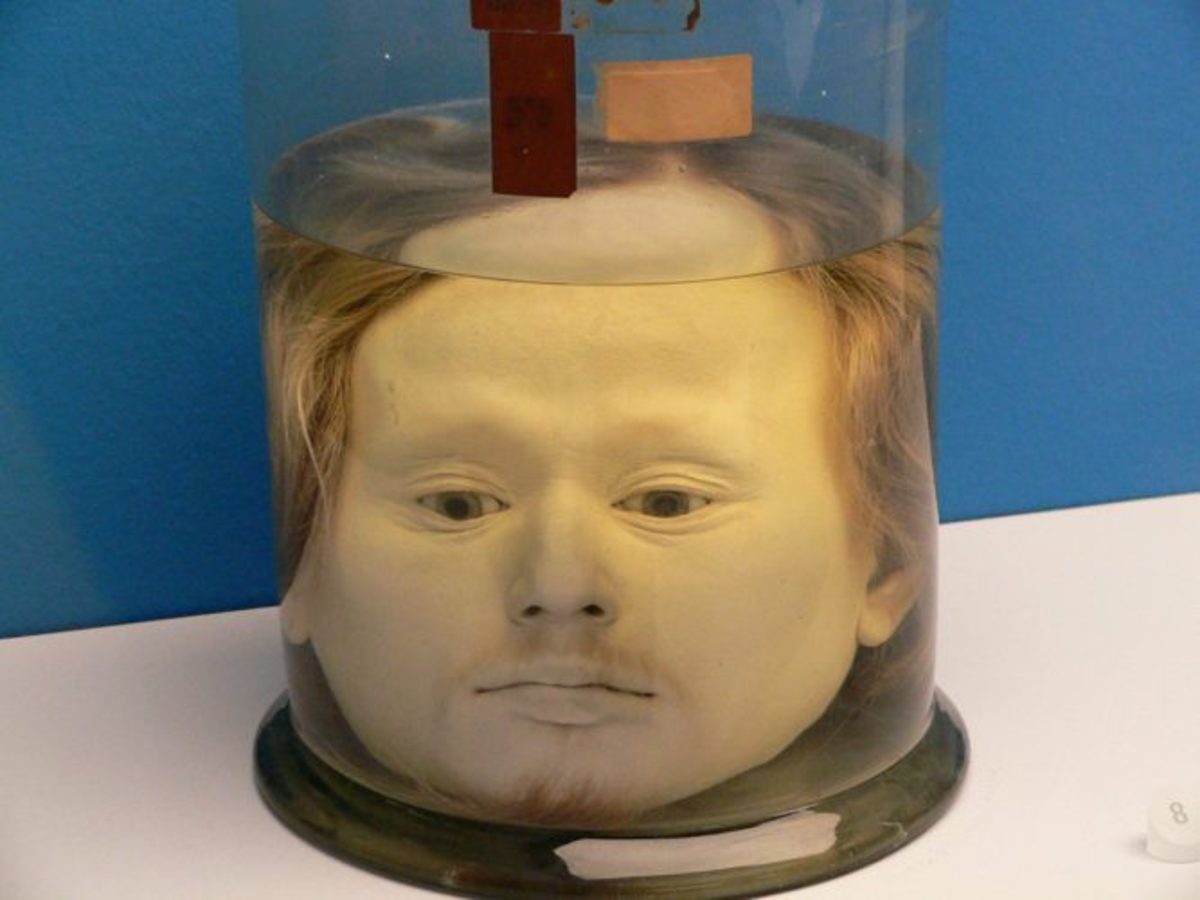 Who Was Diogo Alves, and How Did His Head End up in a Jar?