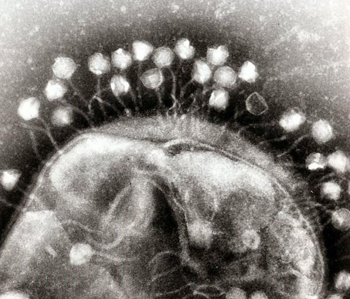 Phages attaching themselves to a bacterial wall