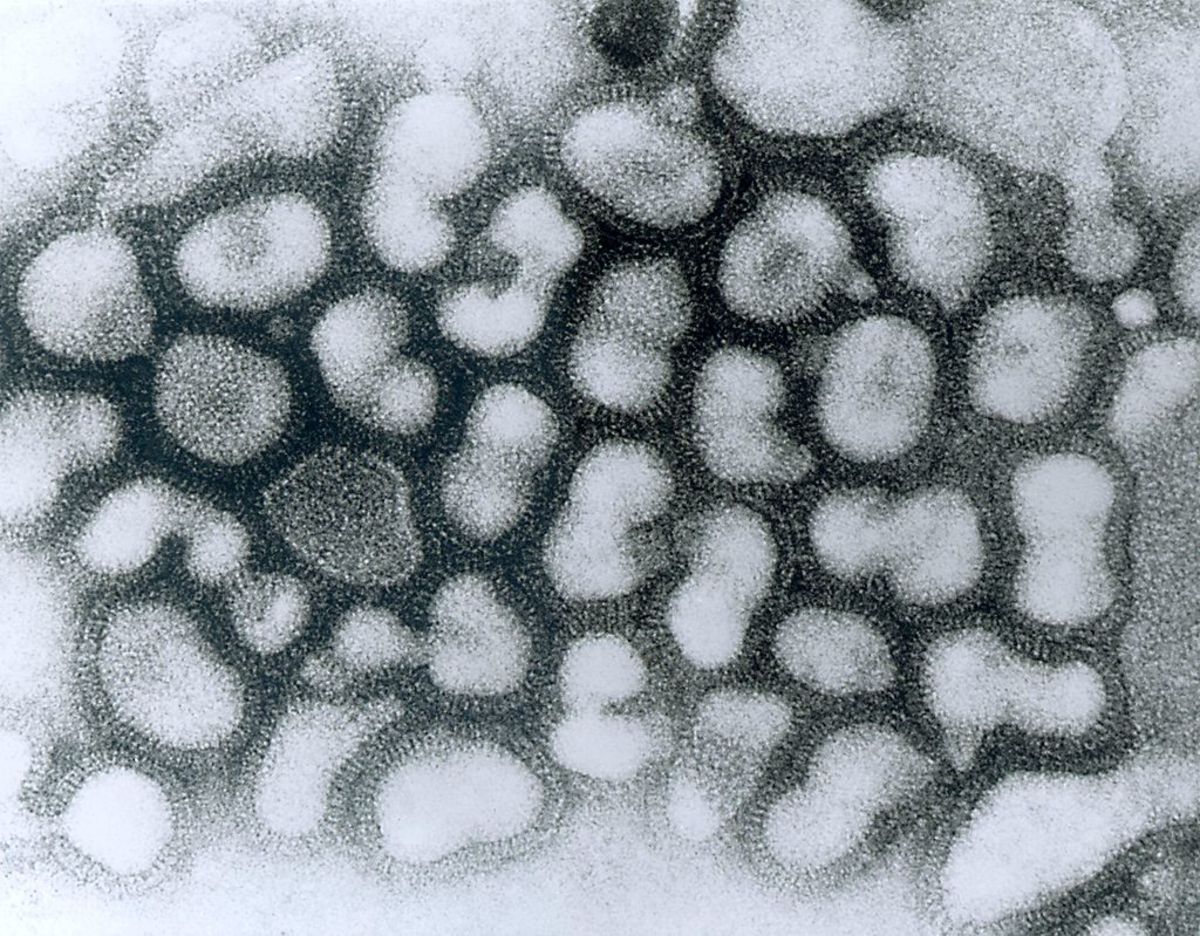 Microscopic image of the H2N2 virus responsible for the Asian Flu.
