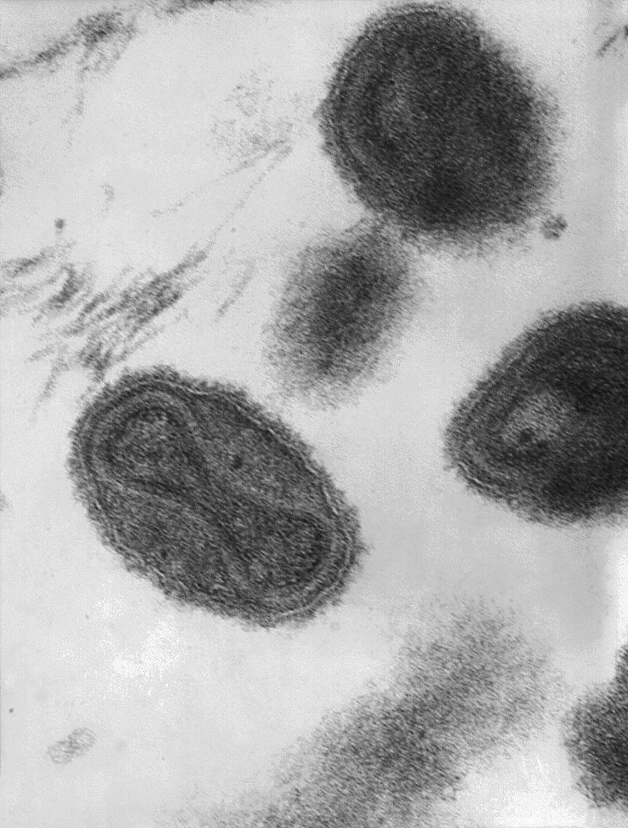 Microscopic image of the Variola Virus (Smallpox). This disease was likely responsible for the Antonine Plague.
