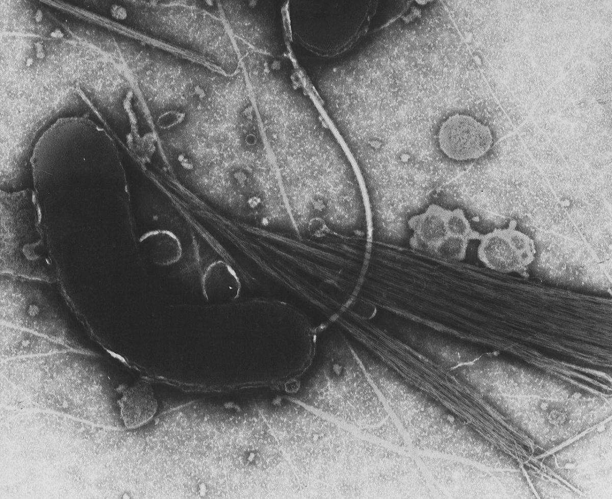 Up-close image of Vibrio cholerae, the bacteria responsible for Cholera.