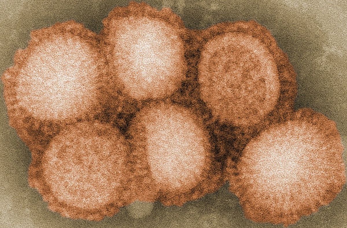 The H3N8 virus responsible for the Russian Flu pandemic.