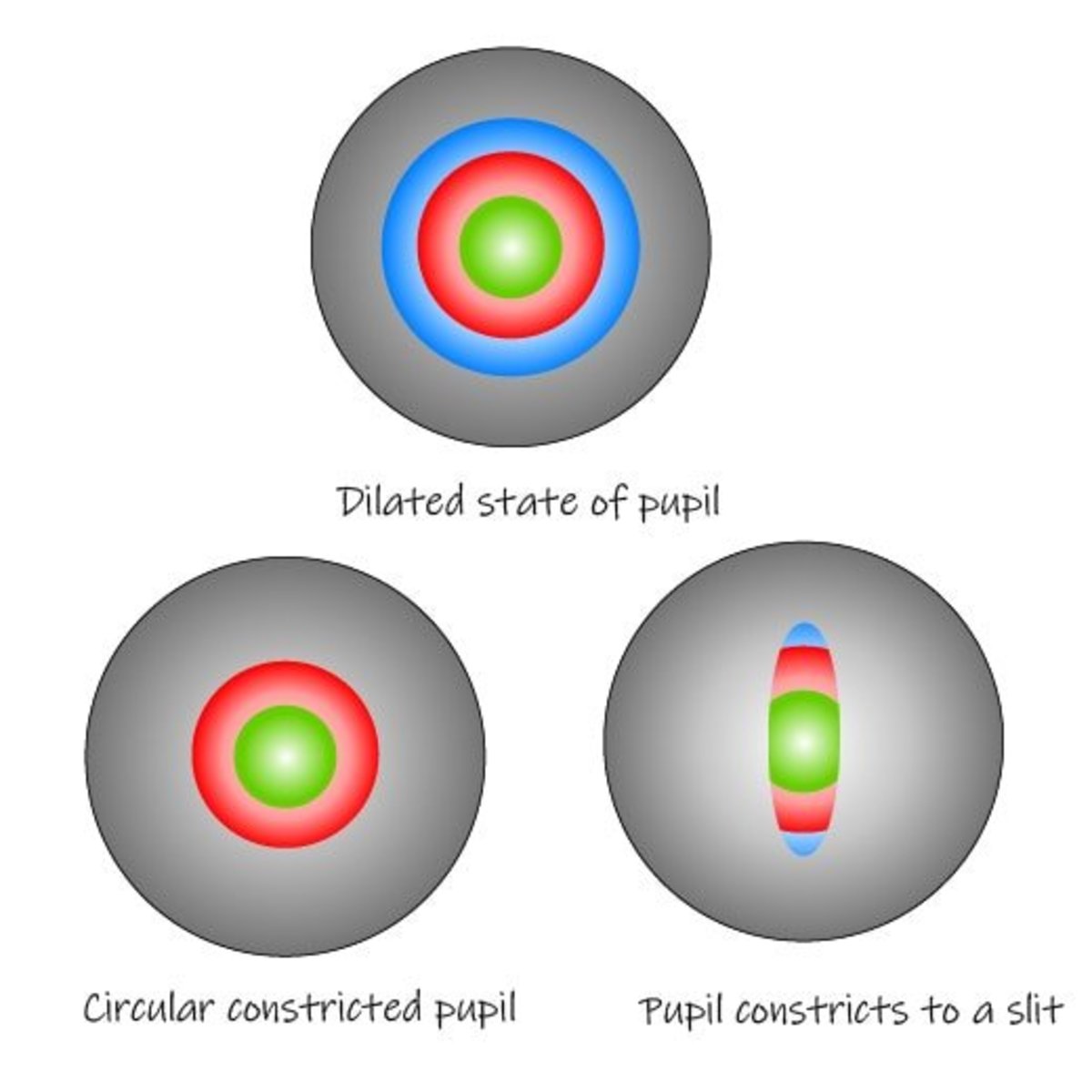 Unlike a circular pupil that loses focus on the outer zone as it constricts, a slit pupil allows light to pass through all zones irrespective of constriction state.