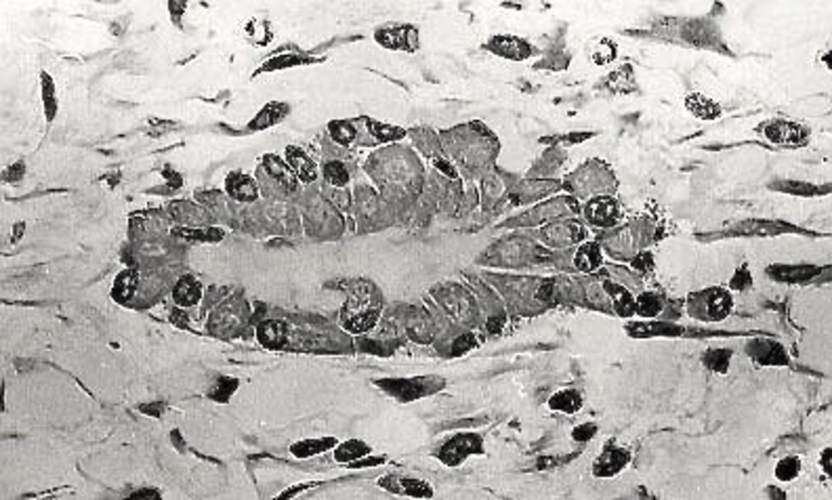 A group of osteoblasts making osteoid, which is shown at the center