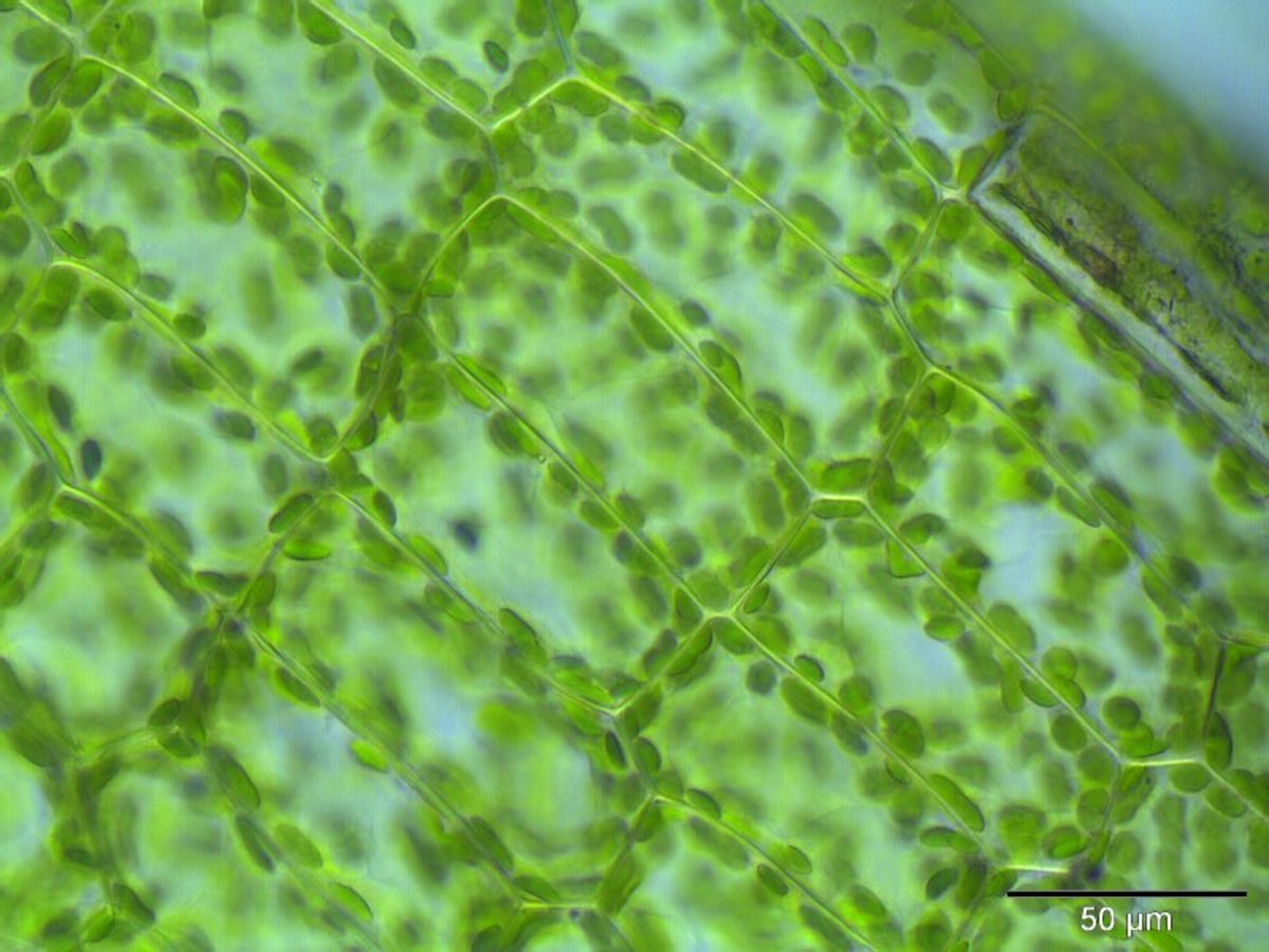 Plant cells with visible chloroplasts (green, circular structures).