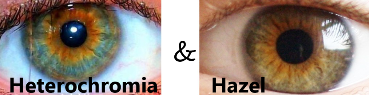 heterochromia-iridum-people-with-two-different-colored-eyes