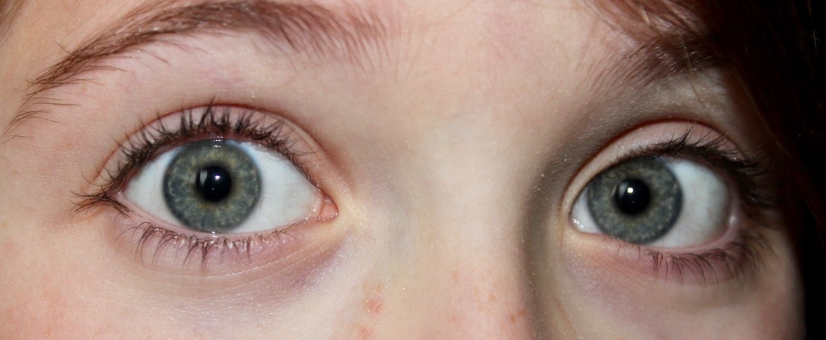 Grey eyes have more collagen in the stroma than blue eyes, which changes the way light scatters and reflects color.