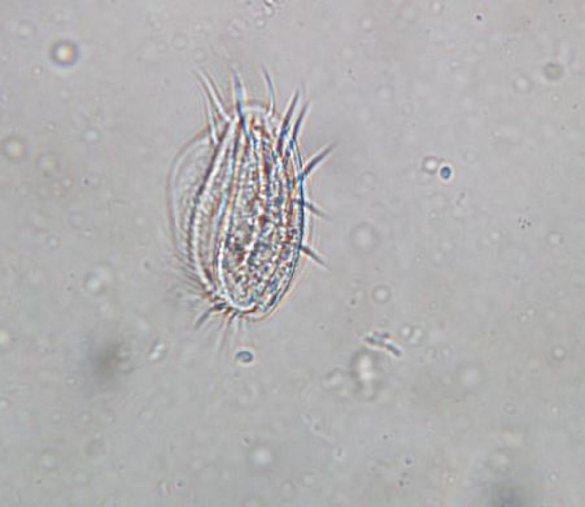 Euplotes sp., a ciliated protozoan found in the pools of Brocchinia and Sarracenia