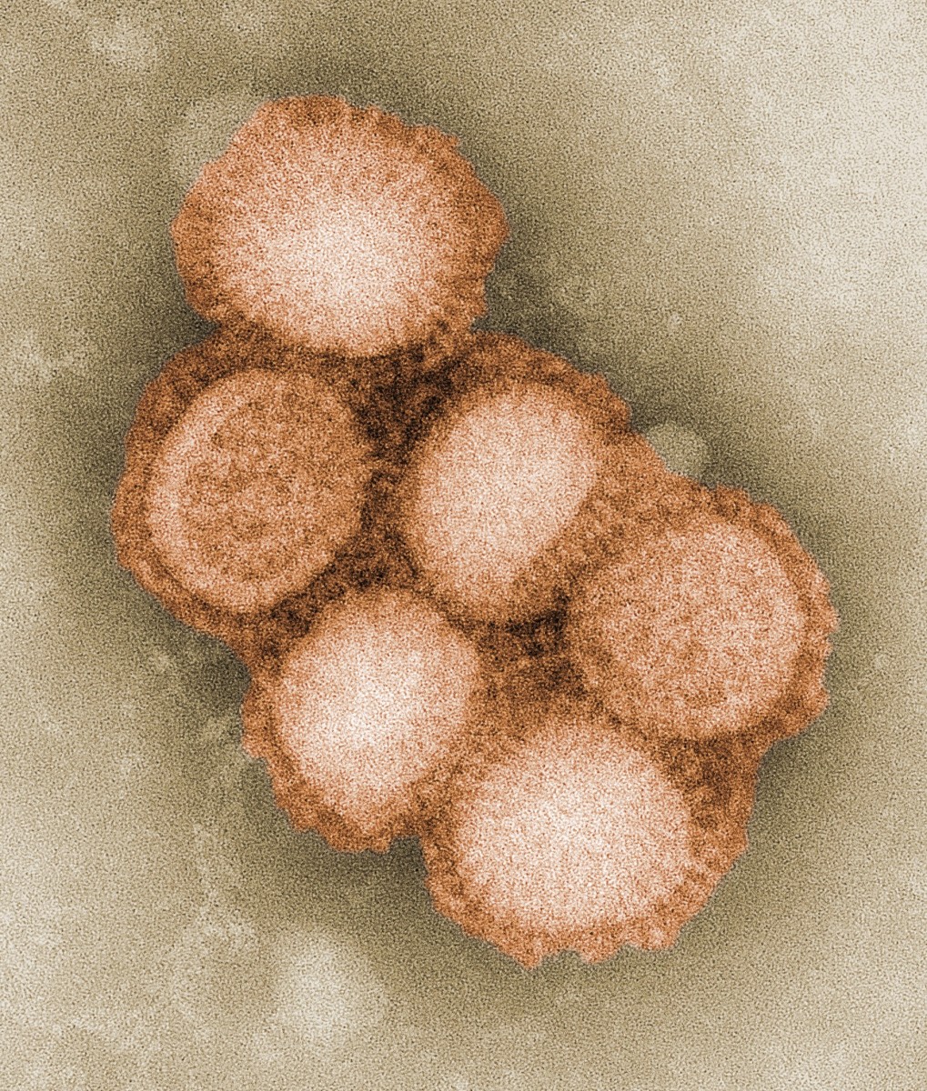 The H1N1 or swine flu virus (a colourized transmission electron micrograph)
