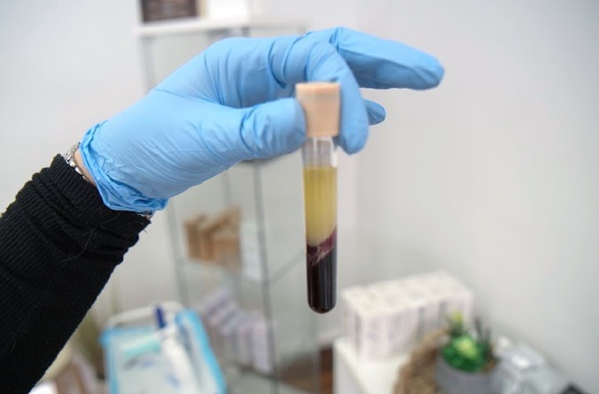 Plasma seperated after centrifugation. On seeing closely, you can observe a layer in the middle called buffy coat. It consists of white blood cells and platelets.