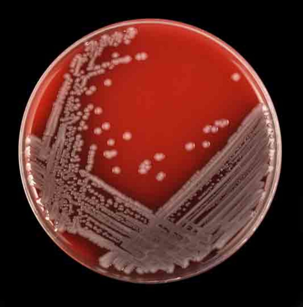 An example of what a microbiology plate looks like with bacteria growing on it. This one happens to be E.coli which is the most common cause of UTIs. 