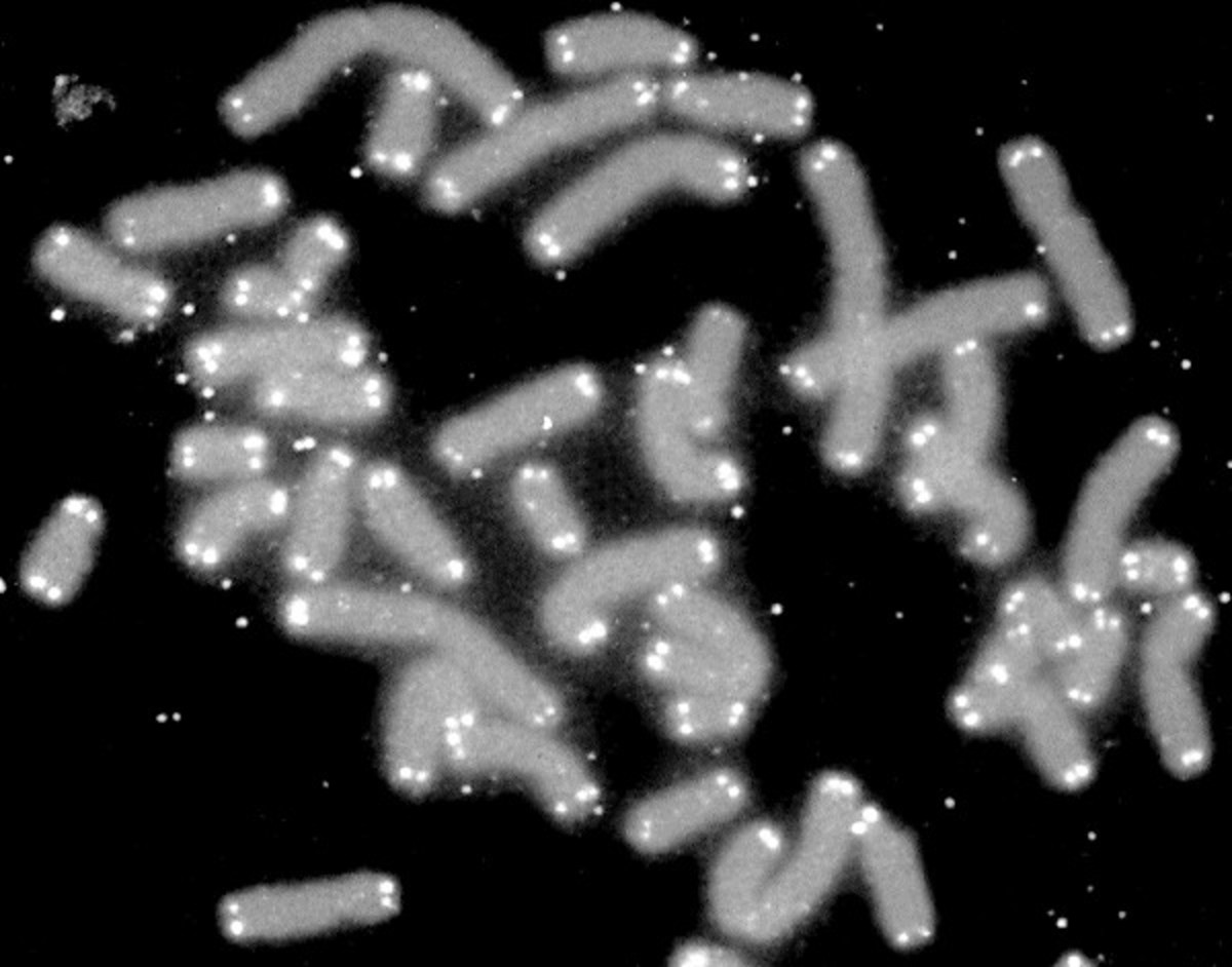 The telomeres are the light spots at the ends of the chromosomes in this photo.
