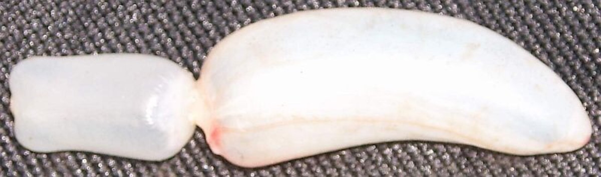 The swim bladder of a rudd, a freshwater fish