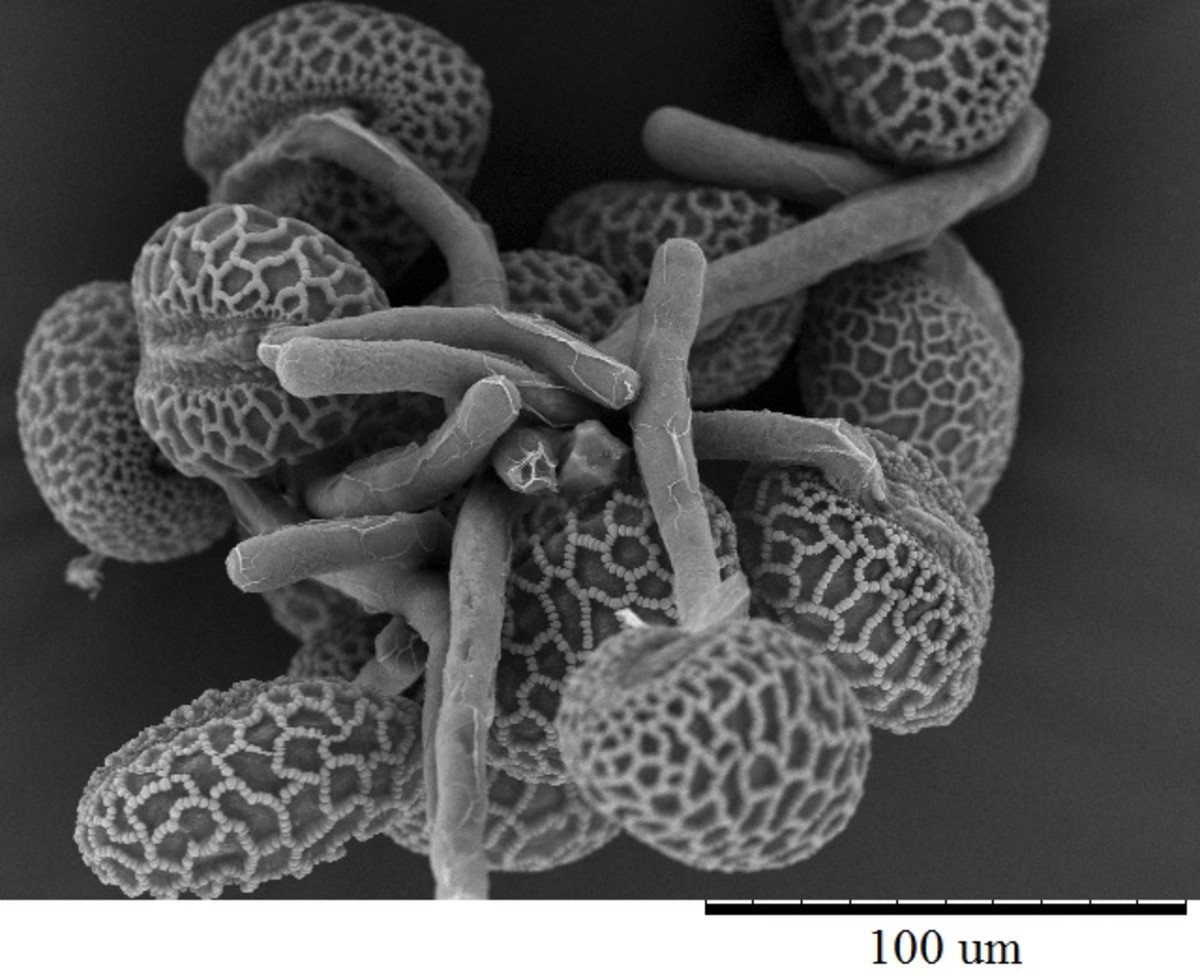 This image shows pollen with growing tubes. The tubes fertilize the female parts of a flower.