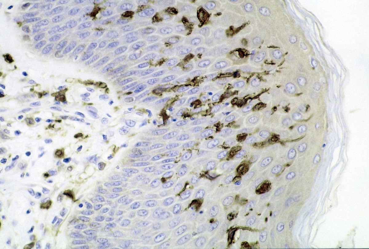 Langerhans cells in the epidermis during an infection, with a stain added to make the dark granules in the cells clearly visible