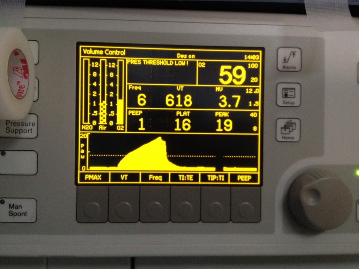 Patient Monitoring During Anesthesia Owlcation