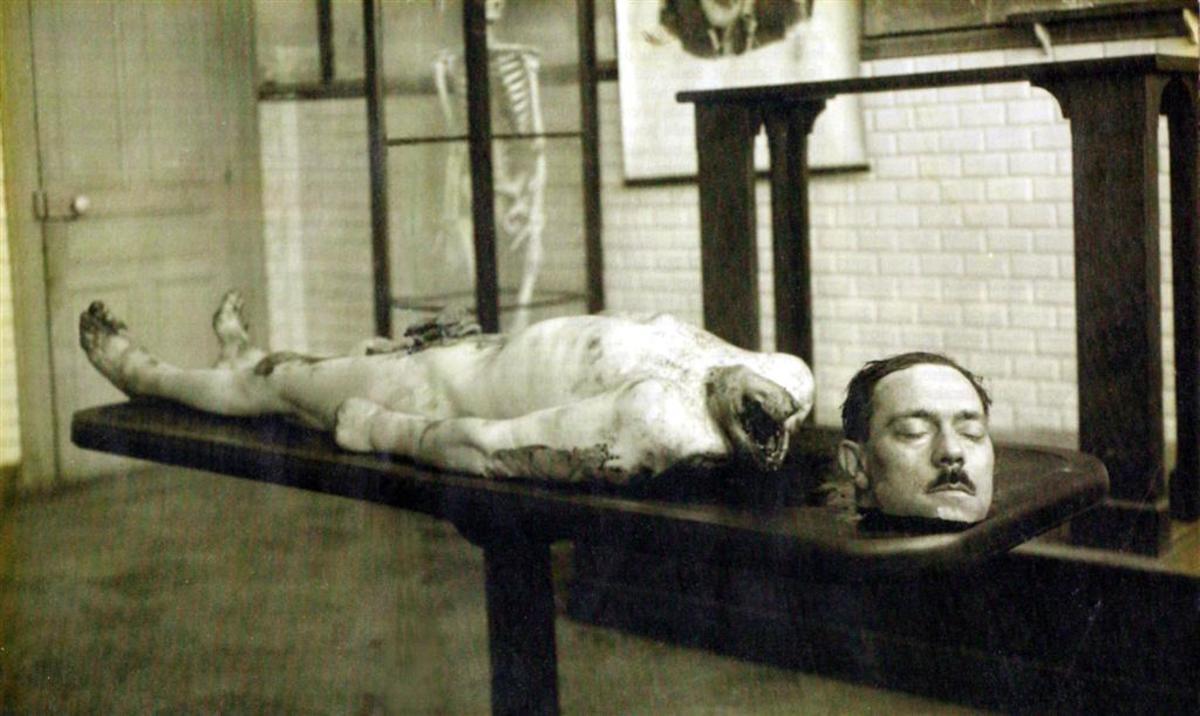 Actual photograph of guillotine victim