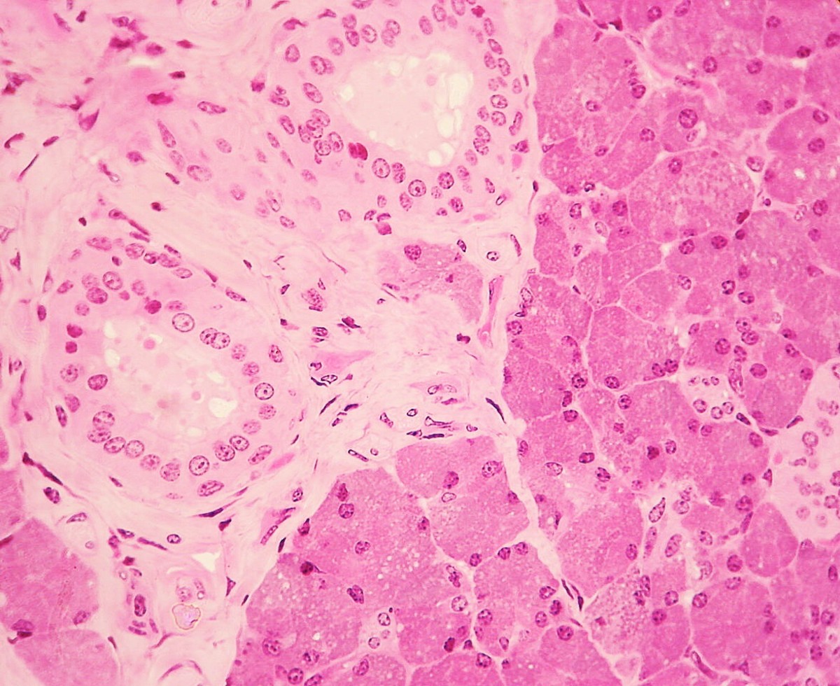 A stained slide showing parotid gland cells; the lighter cells are part of a duct