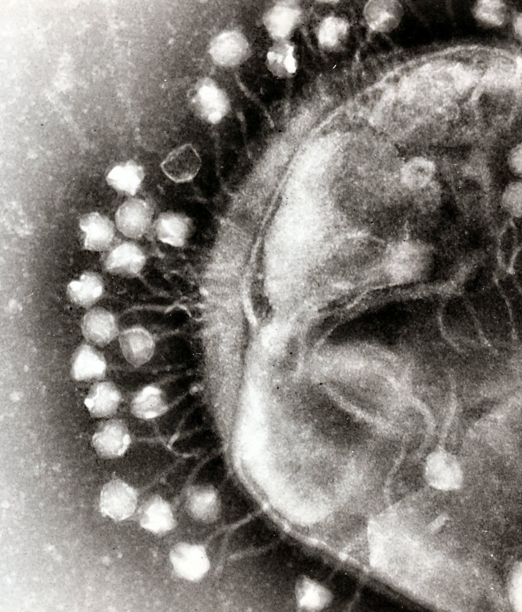 Bacteriophages attached to the outside of a bacterial cell.