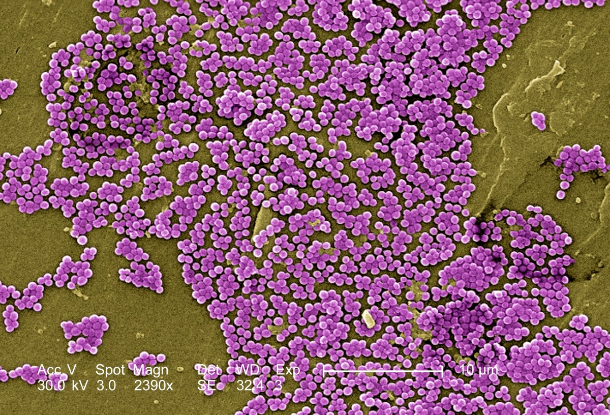 A colorized view of MRSA cells, or Methicillin-Resistant Staphylococcus aureus, which is resistant to several common antibiotics.