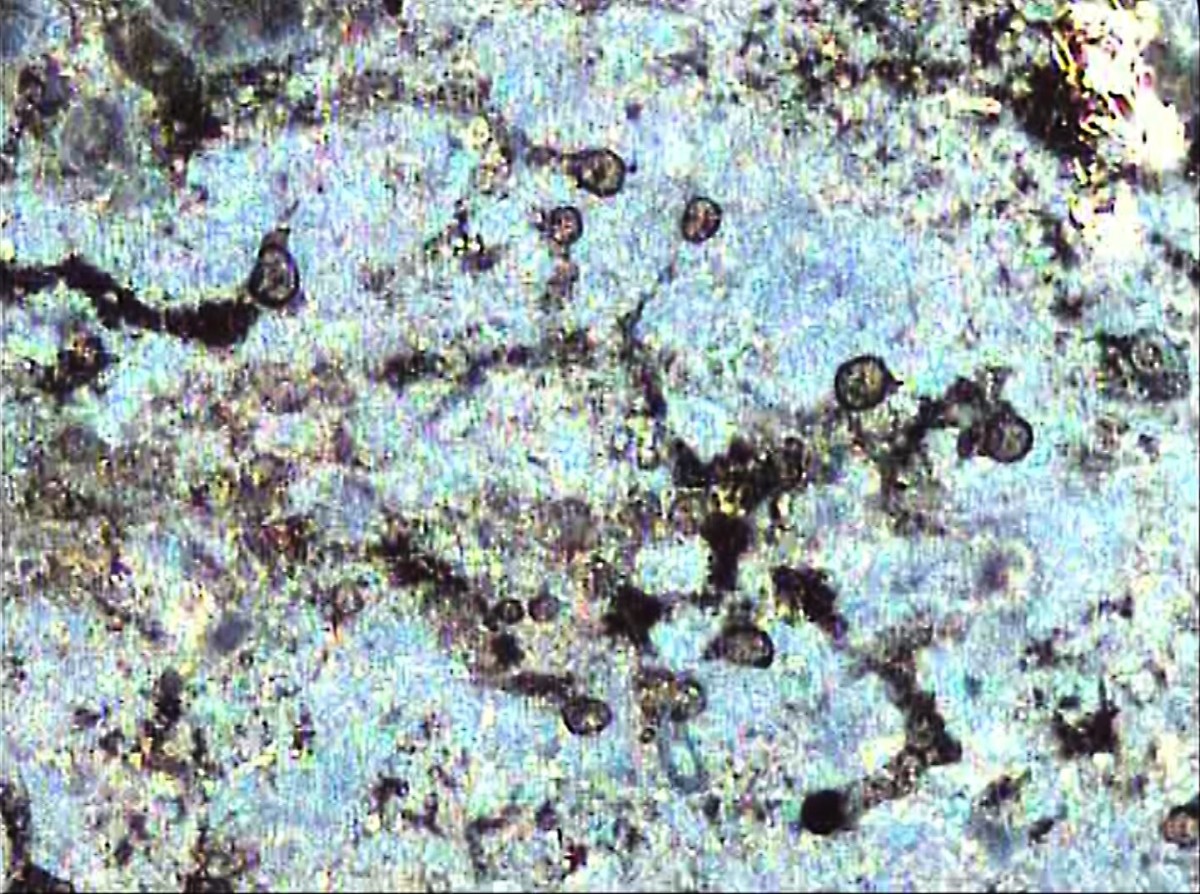 A stained periodontal biofilm that contains bacteria and amoebas, which are not bacteria; the black channels show where an amoeba has moved through the biofilm