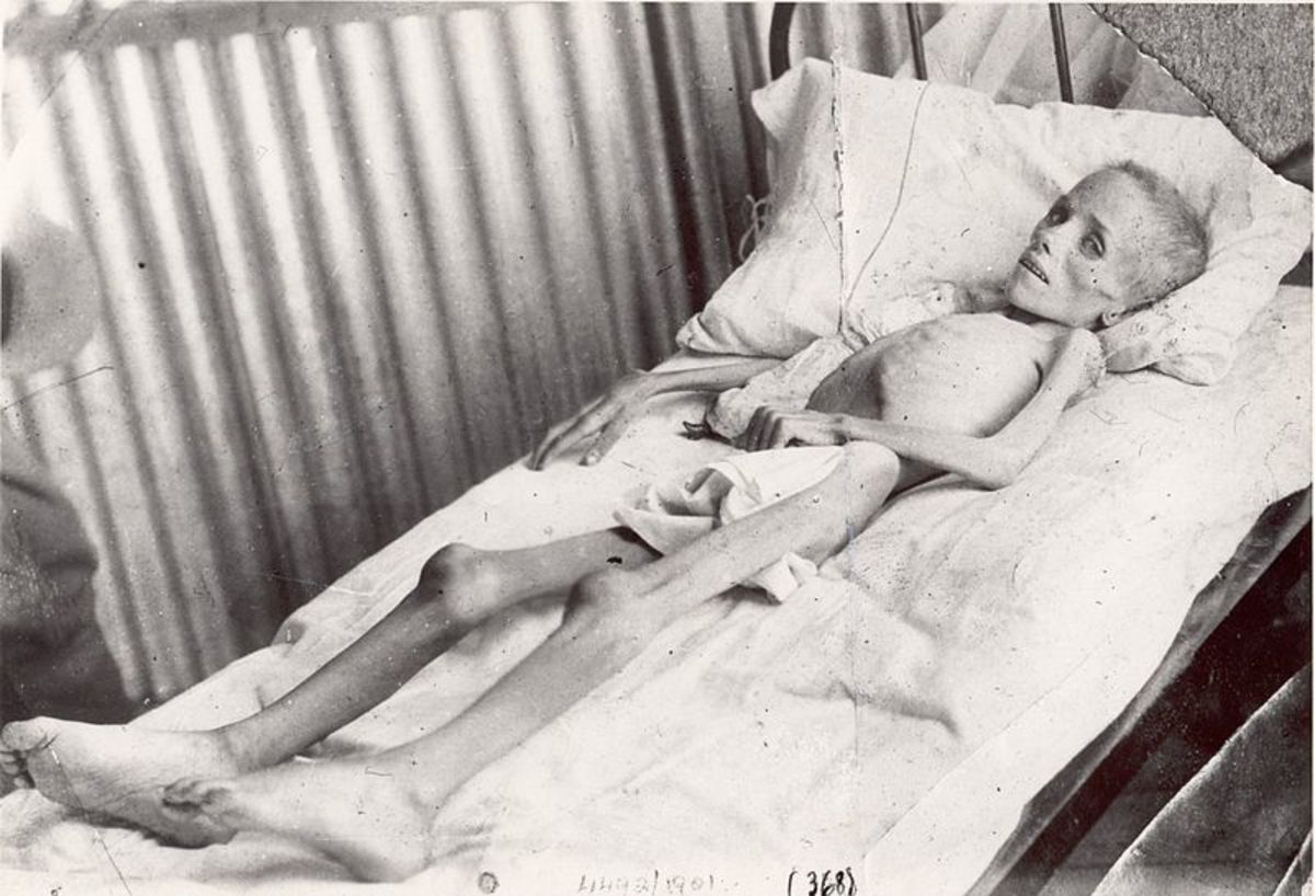 Lizzie Van Zyl, one of the 24,000 or so Boer children that died in British concentration camps. British nurses refused to care for her, instead labeling her a nuisance due to her inability to speak English.