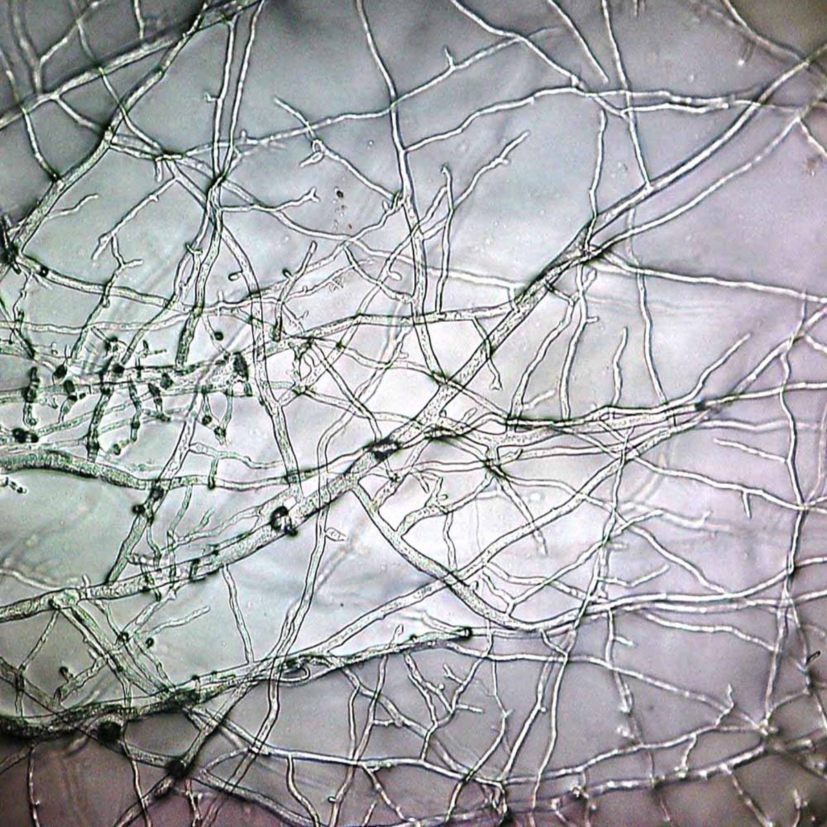 The mycelium or body of a mold (a type of fungus) as seen under a microscope