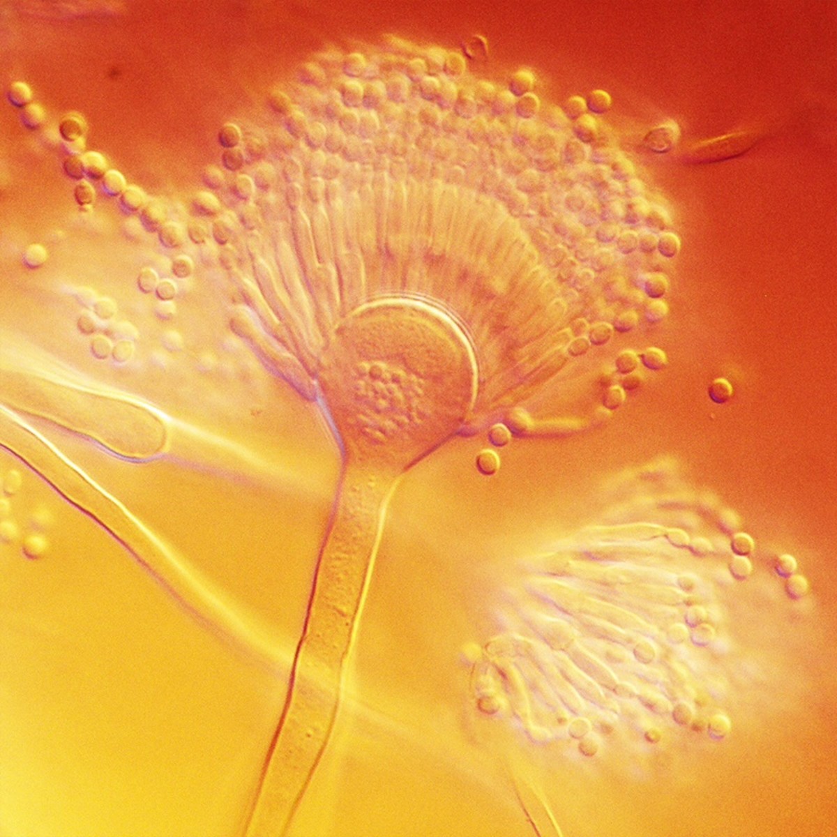 Aspergillus terreus conidiophores