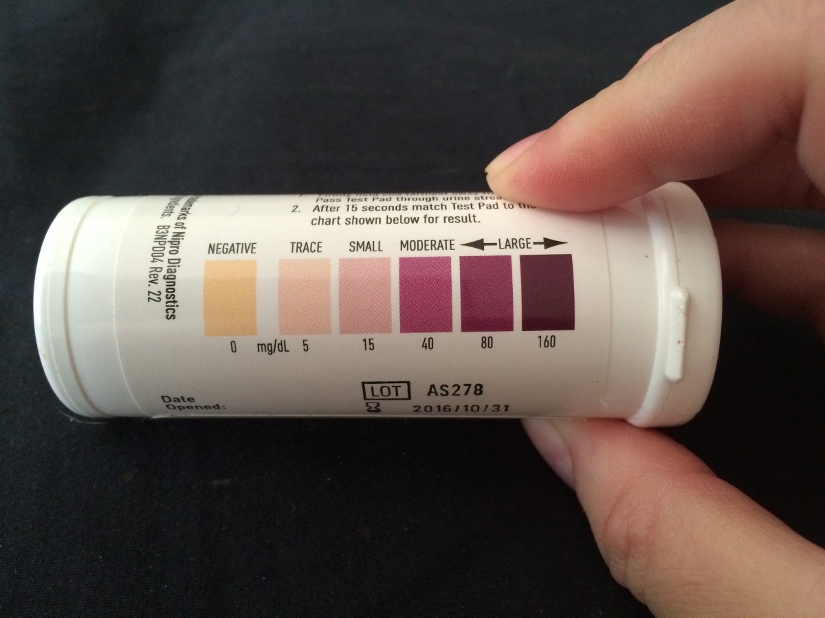 My at-home keytone strip container (My ketones were in the purple range before insulin!).