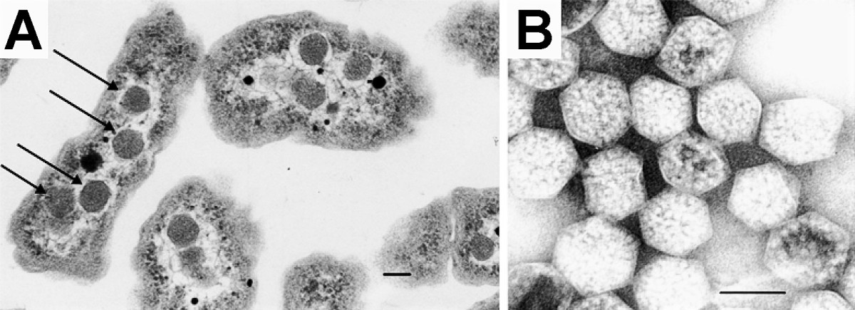 Carboxysomes in a bacterium named Halothiobacillus neopolitanus (A: within the cell and B: isolated from the cell)
