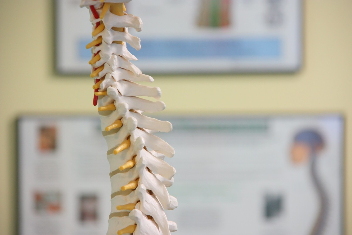 Intervertebral discs (the yellow gelatinous discs between the bony vertebra) cushion the spine and prevent injury.