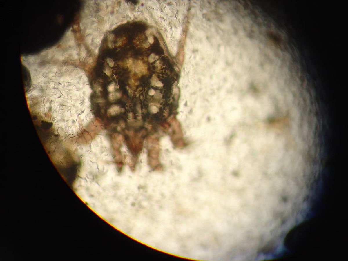 Ear  mite under a microscope.