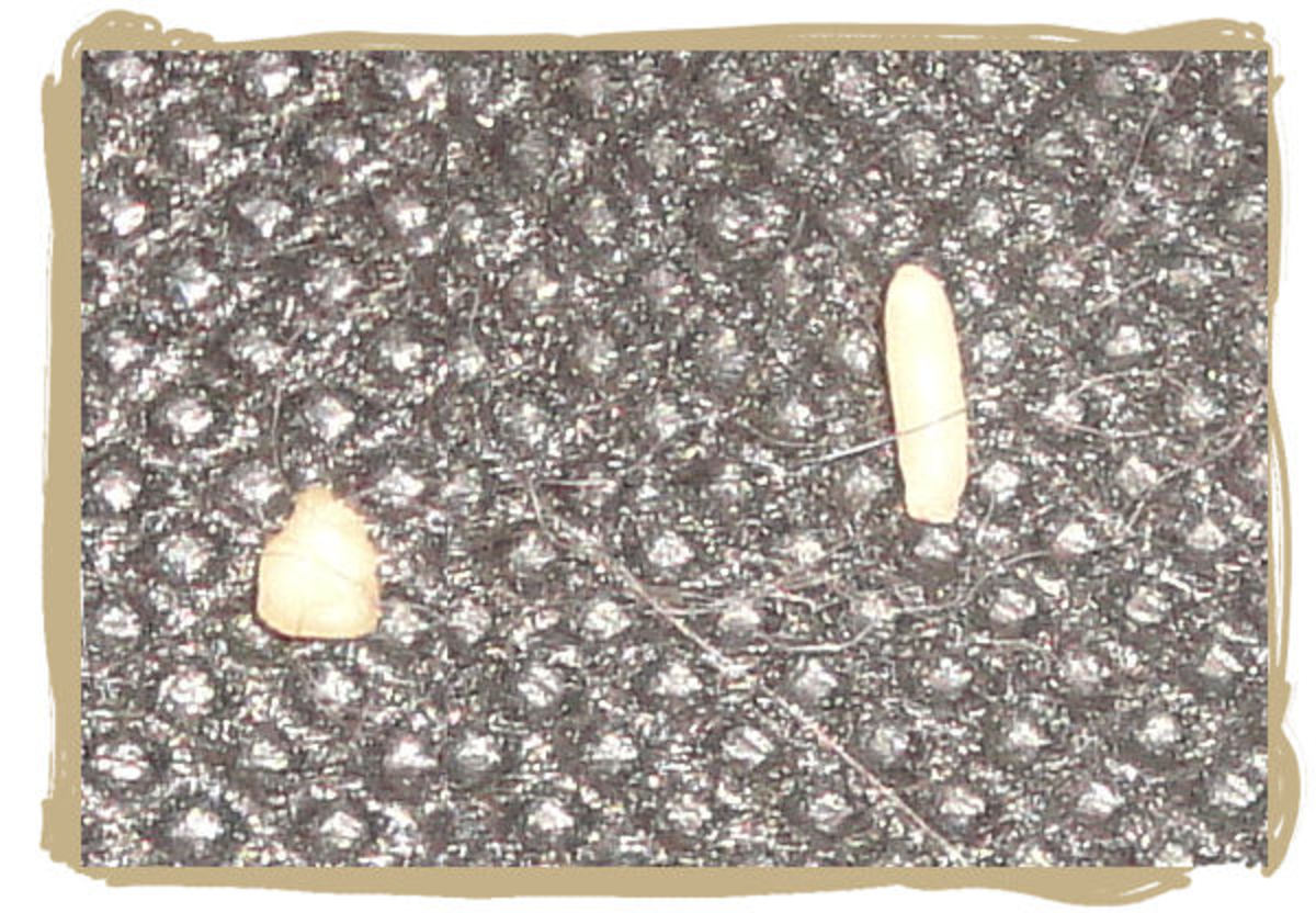 Tapeworm segments close-up.