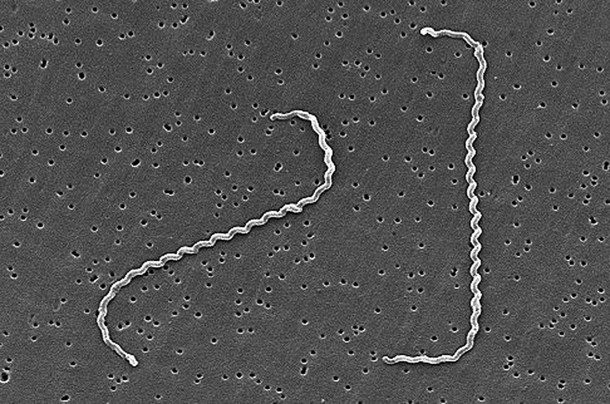 Leptospirosis in Dogs Disease Facts, Treatment, and Prevention