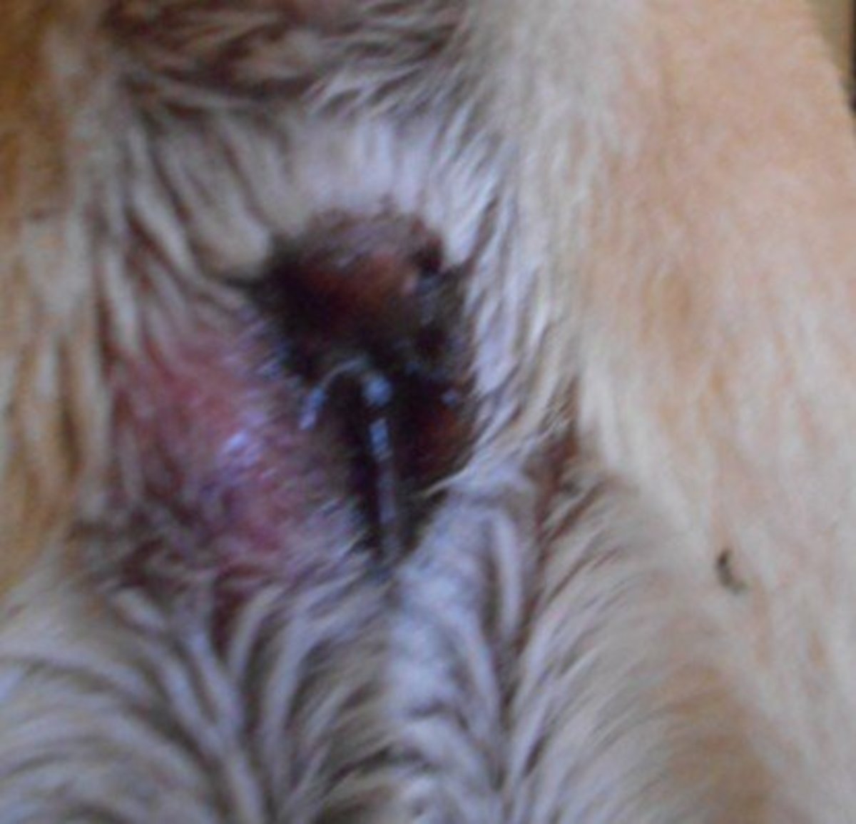 Anus hole near pimple What Causes