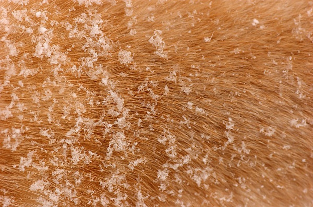Dry-skin dandruff can be very light or very heavy.