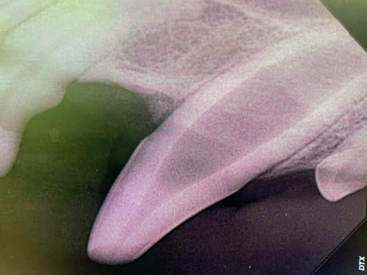 Radiograph of a maxillary canine tooth with a large infected root canal.