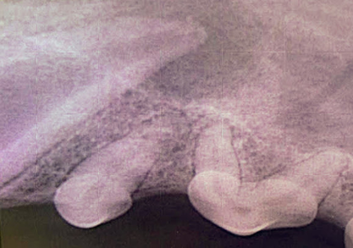 Radiograph of the root tip surrounded by the abscess.