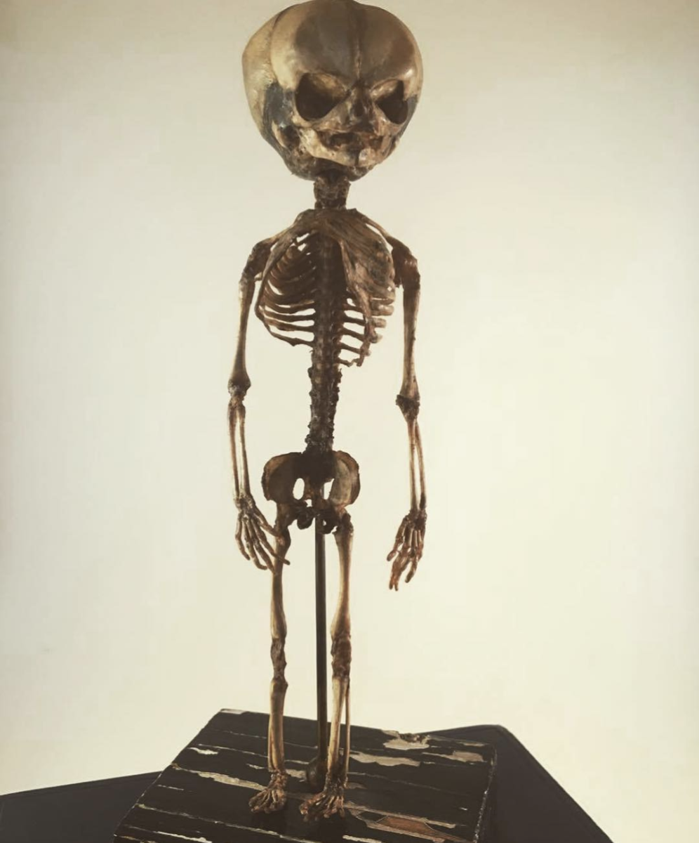 Human fetal skeleton