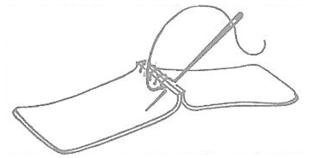 Figure 1: Overhand stitch