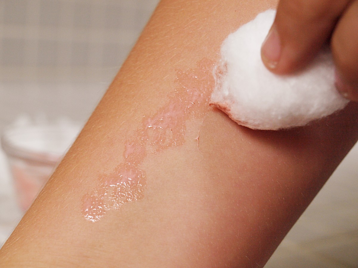 4. Dab the area where you want the fake wound with glue. Use a cotton ball or swab apply a layer of glue.